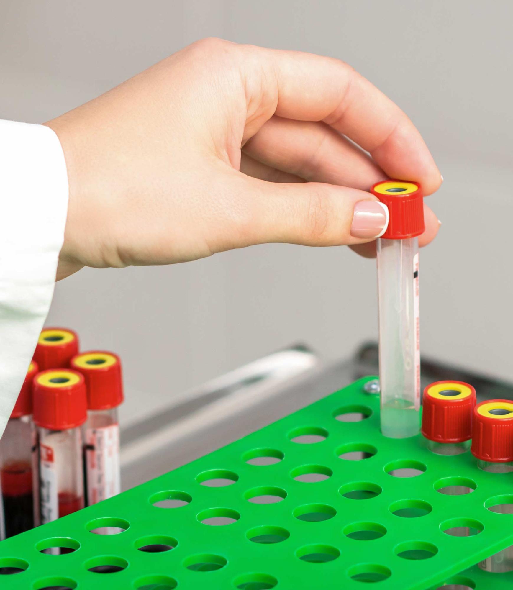 Laboratorionäytteenotto